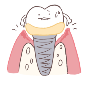 歯ぐきが腫れて骨が減り始めたインプラントのイラスト