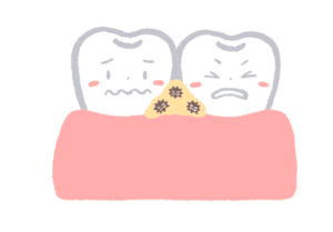 歯と歯の間に食べ物が挟まった歯のイラスト